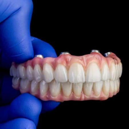 Dentistry-Monterey-CA-All-on-4-New